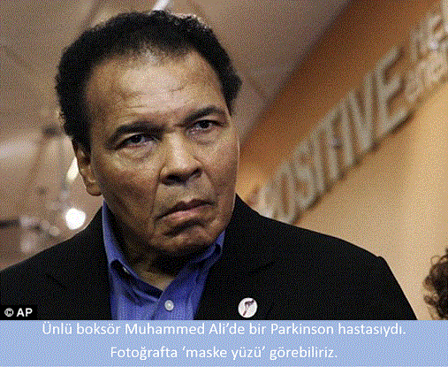 muhammedaliparkinson