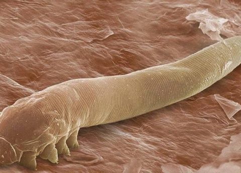 demodex